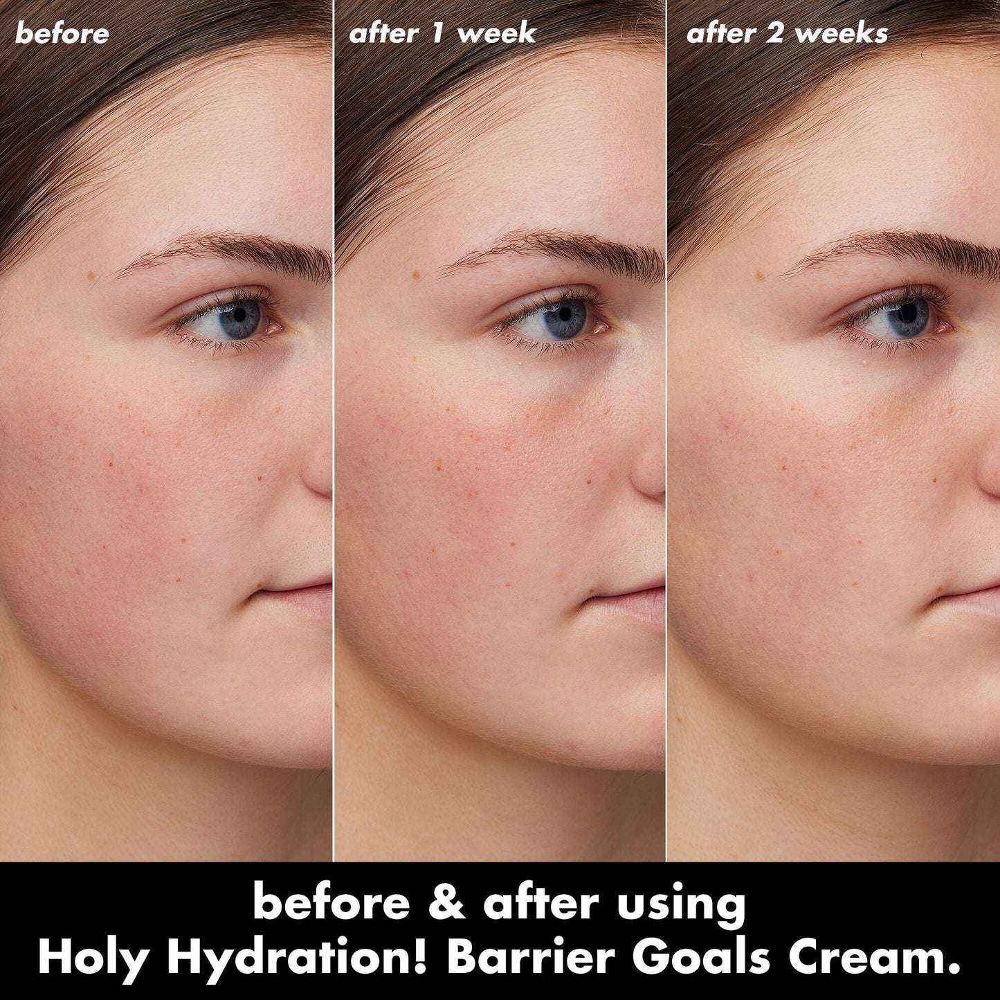holy-hydration-barrier-goals-cream-f8 0226_EDU_HHBarrierGoalsCream_B_A_Zoe_TRYPTICH_710f5249-3a6b-41fd-89e4-817294dd9258.jpg