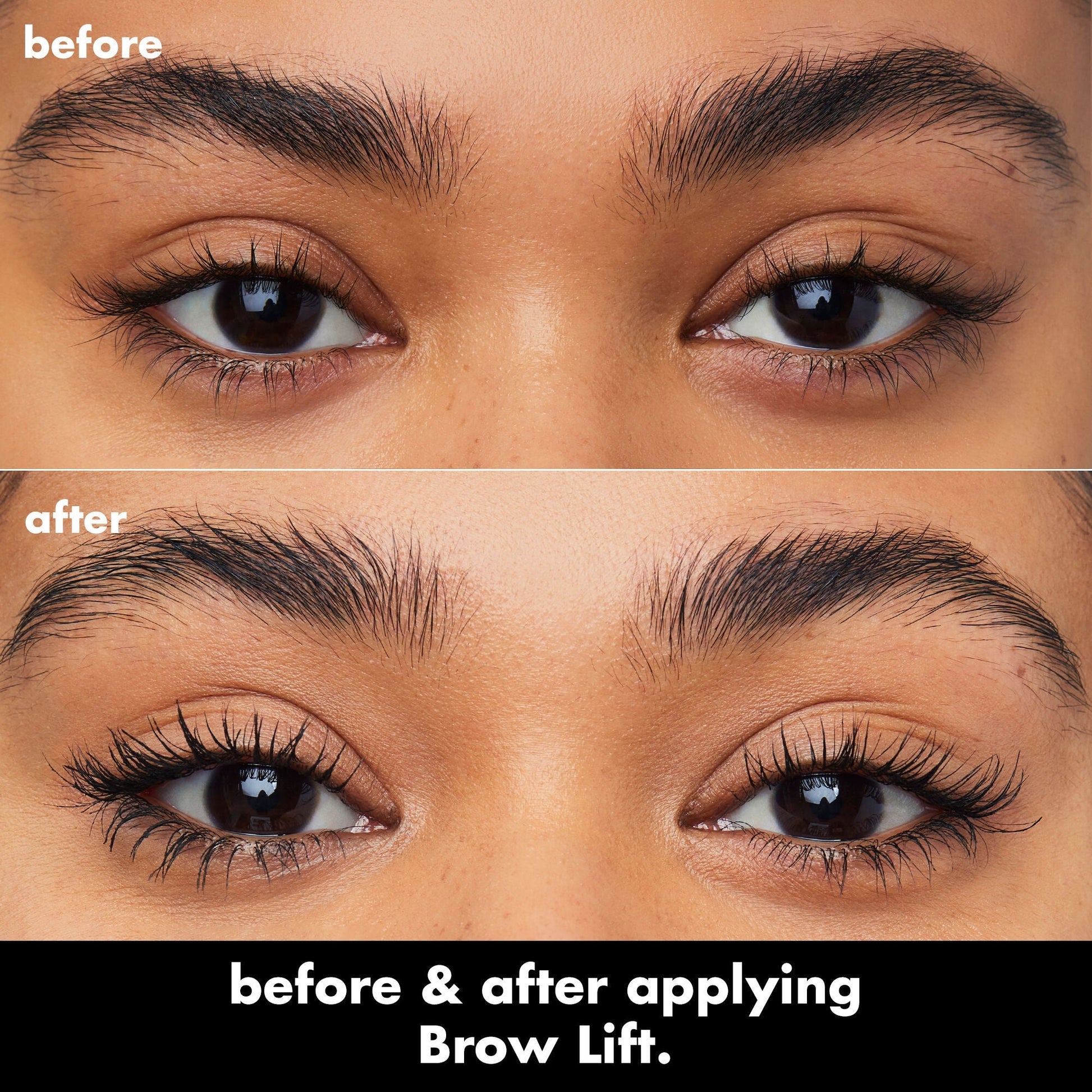 brow-lift-i4 0326_EDU_BrowLift_BA.jpg
