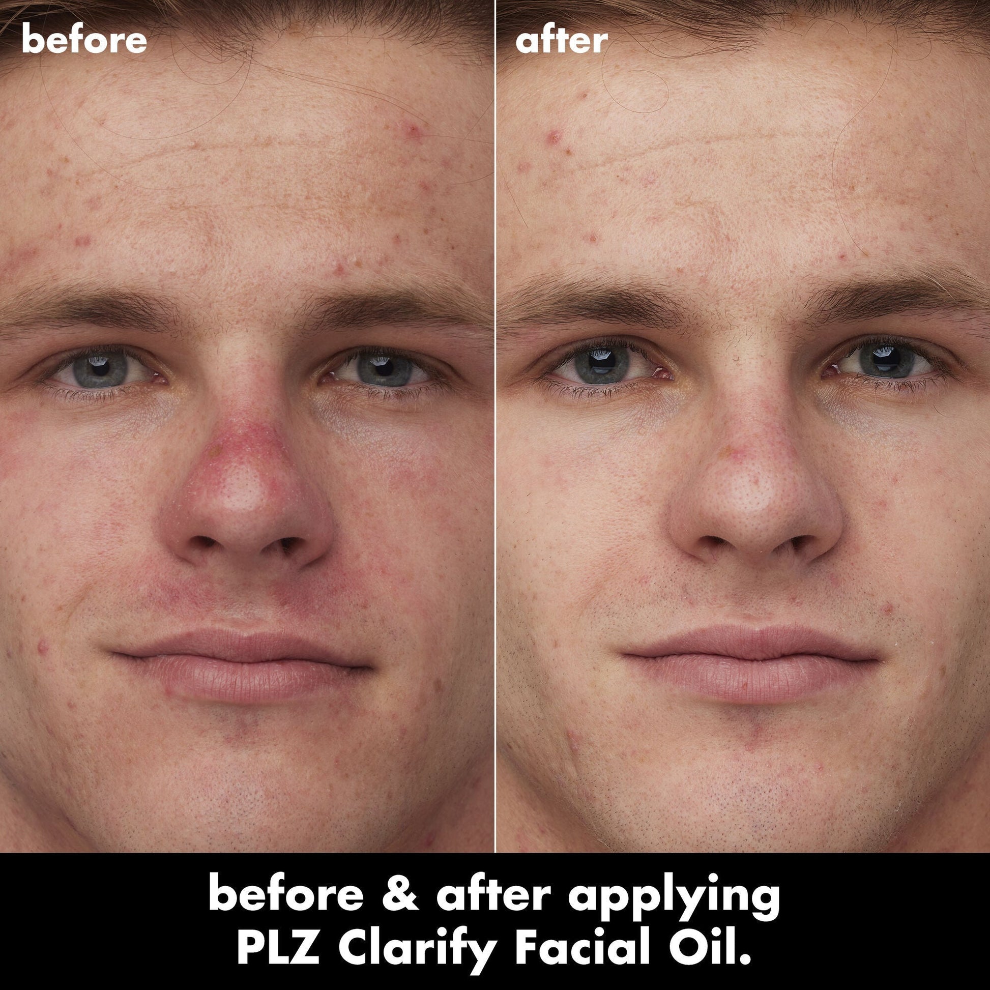 plz-clarify-facial-oil-g7 0326_EDU_PlzClarify_BA_Caleb.jpg