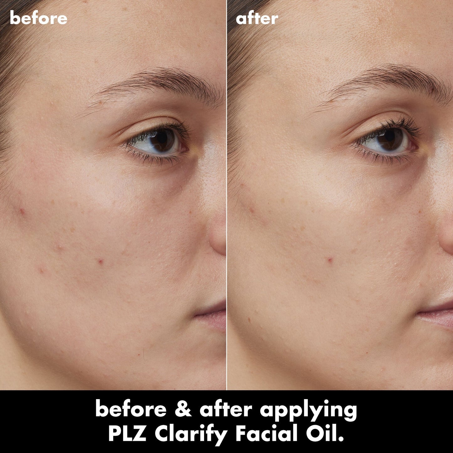 plz-clarify-facial-oil-g7 0326_EDU_PlzClarify_BA_Kelly.jpg