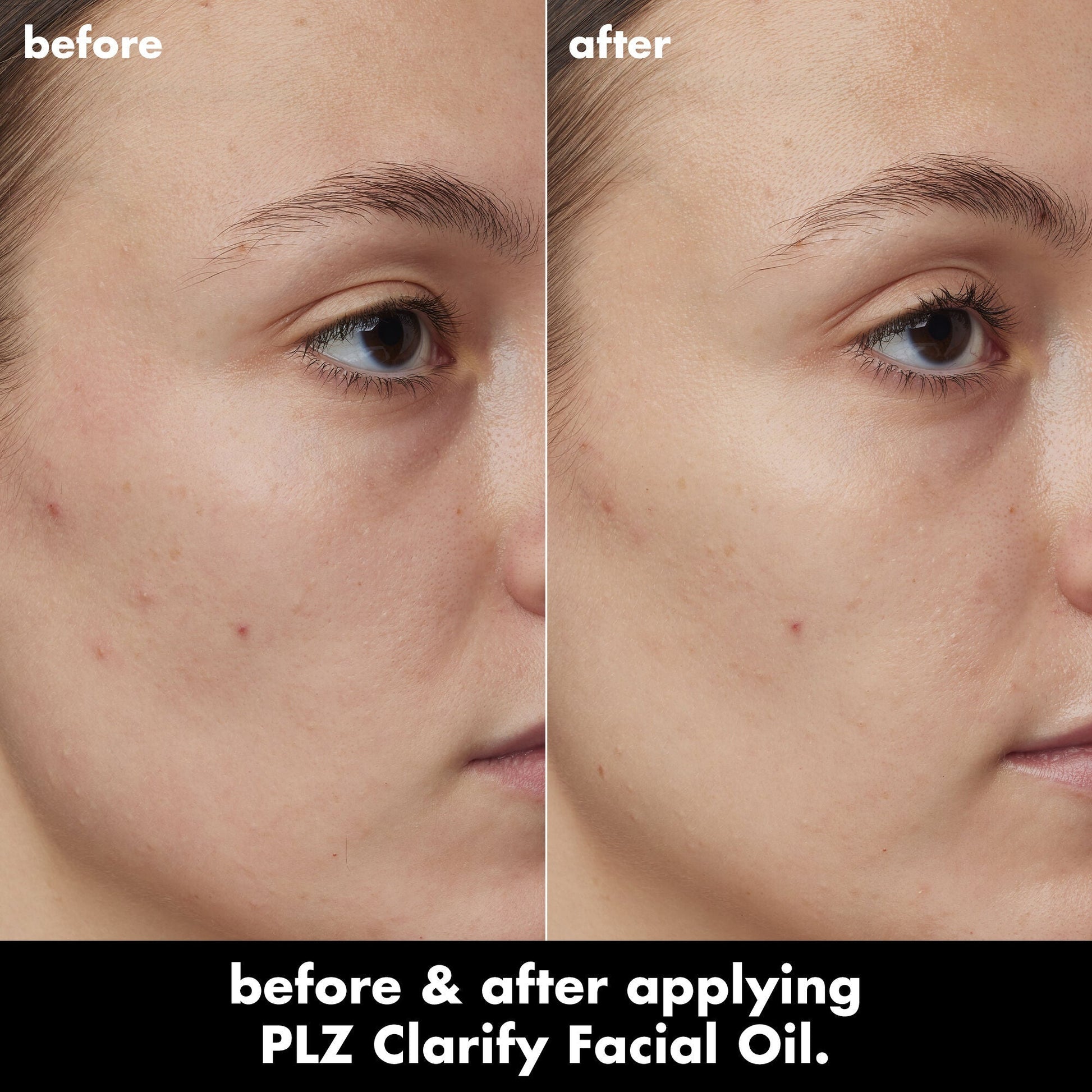 plz-clarify-facial-oil-g7 0326_EDU_PlzClarify_BA_Kelly.jpg