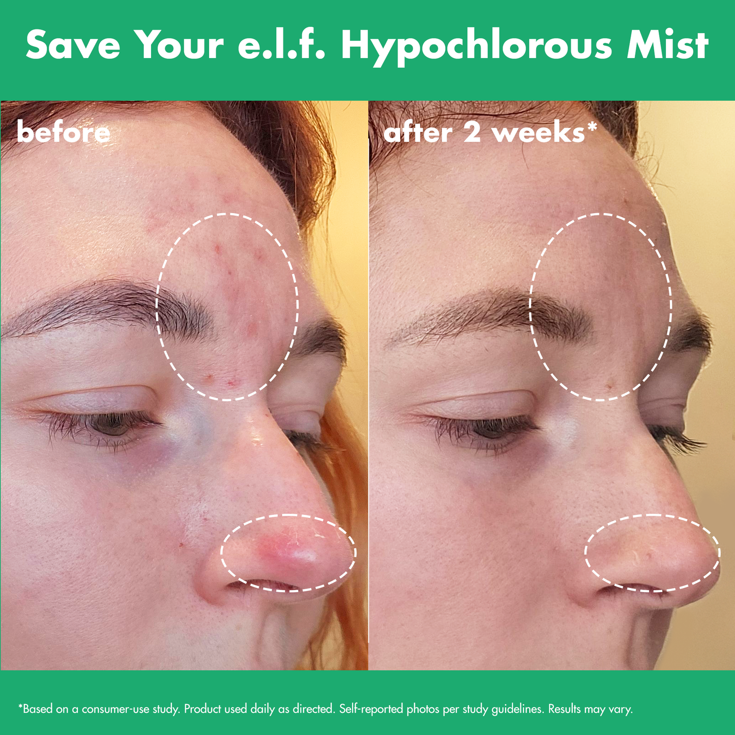 save-your-e-l-f-hypochlorous-mist-z9 FA26_EDUCATION_SAVEYOURELF_USAGE_BA1_WITHOUT_CLAIMS.png